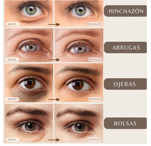 Parches de Oro 24K para Ojos: Hidratación y Rejuvenecimiento Instantáneo