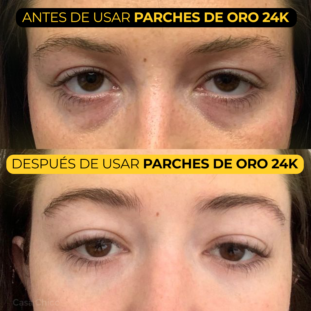 Parches de Oro 24K para Ojos: Hidratación y Rejuvenecimiento Instantáneo