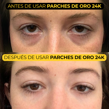 Parches de Oro 24K para Ojos: Hidratación y Rejuvenecimiento Instantáneo